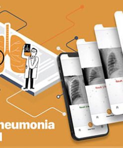 Flutter TensorFlow Lite Artificial Intelligence Application Detection of Lungs Pneumonia COVID 19